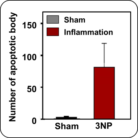 brain