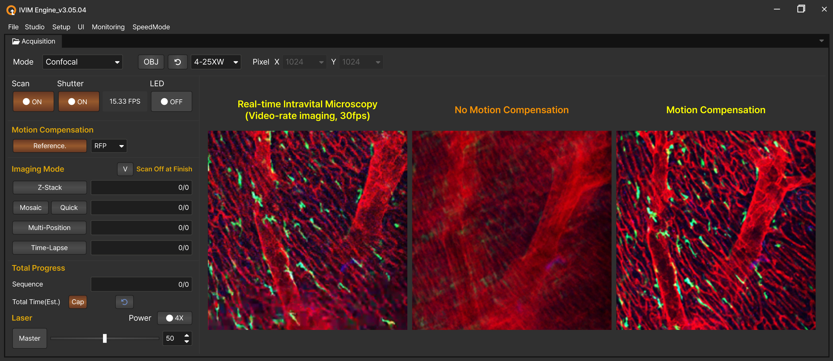 Motion Compensation
